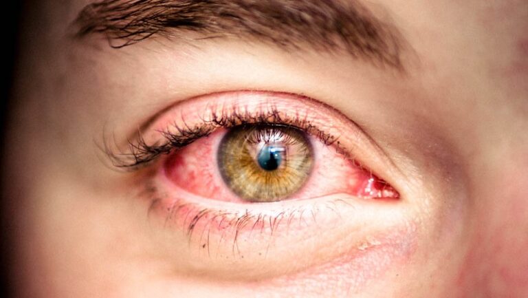 Protege tus ojos de las alergias invernales